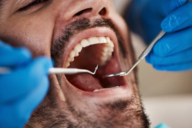Best Broken or Chipped Tooth Repair in Barnesville, GA